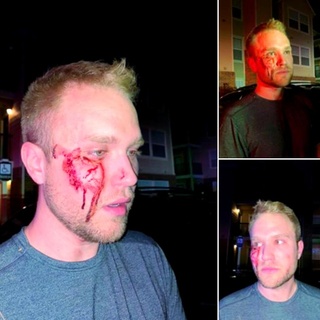 An Oklahoma City realtor says he was beaten unconscious by a pair of assailants who screamed anti-LGBTQ slurs. The pair was arrested and faces misdemeanor charges, reports say. Tap link in bio to read more on @EDGEmedianetwork ?️‍??⁠
⁠
?: Christian Council / Facebook⁠
