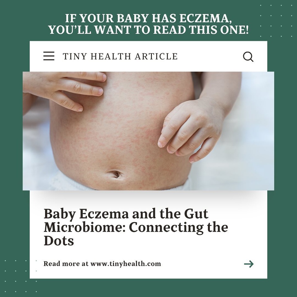 I recently read an article from Tiny Health that hit close to home—“Baby Eczema and the Gut Microbiome.” This article connected so many dots for me! Eczema isn’t just a skin issue; it’s often linked to an imbalance in the gut microbiome, which can disrupt the immune system and lead to conditions like asthma, allergies, and, of course, persistent eczema.

After learning about this connection, I decided to dig deeper and actually test my baby’s microbiome with Tiny Health. The insights were eye-opening! Working alongside one of their consultants, we tailored a plan with the right probiotic and gut-healing foods to support her gut health from within. Knowing exactly what her microbiome needed made all the difference, and I’m so grateful for how much it’s helped her skin heal.

Beyond the probiotics, we also focused on incorporating ancestral, gut-friendly foods to nourish her body and encourage balance. Now, her skin is clear, and I feel so empowered knowing that we’re supporting her health from the inside out.
If you’re interested in understanding how gut health impacts eczema or want to take a closer look at your baby’s microbiome, I can’t recommend Tiny Health enough! ?

? I have a special code to get $40 OFF @tiny.health Kits: REF-BIANCA0755
 ? Link to the full article in my bio – a must-read for any parent dealing with eczema!

#BabyEczema #GutHealthForBabies #MicrobiomeTesting #EczemaRelief #TinyHealth #GutSkinConnection #HealingFromWithin #NaturalEczemaRelief #BabyWellness #HolisticParenting #AncestralNutrition #GutHealingFoods #BabyGutHealth #ProbioticsForBabies #EczemaAwareness #GutHealthJourney #NaturalBabyCare #EczemaAndAllergies #ImmuneSupportForBabies #BabyNutrition #RealFoodForBabies #EczemaHealing #NourishingTraditions #HealingTheGut #WholeBodyHealth #EczemaSupport #MicrobiomeBalance #HealthyGutHappyBaby #BabyAndToddlerHealth