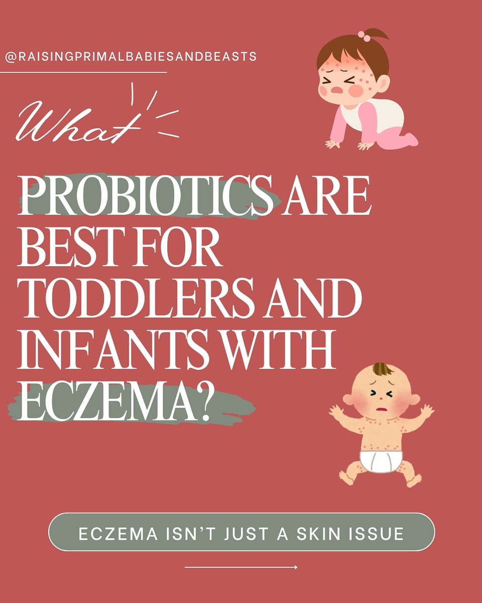? Best Probiotics for Baby Eczema – What Worked for Us! ✨

? Want my FREE guide: Heal Your Baby’s Gut and Transform Your Family’s Health?
? Comment “PRIMAL KITCHEN” and I’ll send it to you!

? Want a full breakdown on using probiotics for babies & toddlers + how long to supplement? ? Comment “BLOG” and I’ll send you my full guide!

? Want the link to Smidge Infant Probiotic? ? Comment “SMIDGE” and I’ll send it to you!

If your baby is struggling with eczema, food sensitivities, or dry, irritated skin, their gut health could be the missing piece. Eczema isn’t just a skin issue—it’s often a gut imbalance, where inflammation and missing beneficial bacteria lead to immune dysfunction and skin flare-ups.

? Why Are Babies Affected by Eczema? ✔️ Imbalanced Gut Microbiome – Babies born via C-section, exposed to antibiotics, or formula-fed often lack key bacteria that protect against inflammation. ✔️ Leaky Gut & Food Sensitivities – A weakened gut lining allows proteins (like dairy & gluten) to trigger immune reactions that show up as eczema. ✔️ Lack of Bifidobacteria – Bifidobacteria are critical for gut balance, reducing inflammation, and strengthening the immune system—but many babies today are missing these strains!

✨ What Helped My Daughter? Smidge Infant Probiotic! She was missing bifidobacteria, and this probiotic helped restore balance! Smidge Infantis is designed for babies with eczema, colic, and food sensitivities, providing: ✔️ B. infantis, B. breve, B. bifidum – Found in breastfed babies, these strains support gut integrity & reduce inflammation. ✔️ No fillers, additives, or common allergens – Safe for sensitive little bellies. ✔️ Supports digestion & skin healing – By sealing the gut lining and reducing inflammatory responses.

? How to Know What YOUR Baby Needs? Tiny Health Gut Testing! Instead of guessing which probiotic to use, Tiny Health tests your baby’s gut microbiome, revealing missing strains & imbalances so you can heal from the root!

? Want $40 off your first Tiny Health gut testing kit? ? Comment “TINYHEALTH” and I’ll send you the coupon!