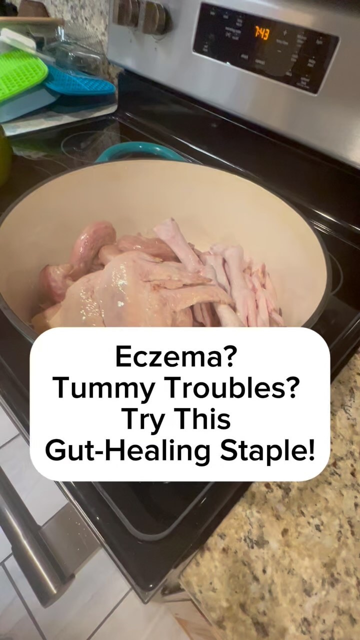 Hey mama, have you tried using meat stock for your little ones yet? ? 

It’s one of the most powerful tools for healing and nourishing from the inside out—and it’s a GAPS diet essential for a reason! Let me break it down for you. ?‍?‍?✨

What makes meat stock so special?
 Unlike bone broth, meat stock is cooked for a shorter time, making it easier to digest while still packed with gut-healing nutrients like gelatin, collagen, and amino acids. These work together to rebuild the gut lining, calm inflammation, and support healthy digestion.

Who benefits the most?
 If your baby or toddler is dealing with eczema, food sensitivities, tummy troubles, or even behavioral challenges (yes, the gut-brain connection is real!), meat stock can be a game-changer. It helps soothe the gut and supports a healthy microbiome, which impacts their immunity, sleep, and even mood. ?

How do I use it?
 It’s easier than you think! Here are some simple ways to get started:
* Stir a spoonful into veggie purees—carrot, squash, or even sweet potato work great! ?
* Use it as a base for cooking grains like rice, millet, or quinoa for older kiddos. ?
* Add it to soups, stews, or casseroles—it’s perfect for family meals.
* Drizzle it over scrambled eggs or mix it with mashed avocado for a quick nutrient boost. ?
* Freeze it into cubes or popsicles for a fun teething remedy!

This isn’t just about sneaking nutrition in—it’s about rebuilding health from the foundation up. Meat stock is gentle, nourishing, and perfect for sensitive systems, especially if you’re starting your family on the GAPS protocol. ?️✨

? Need more ideas or tips? Comment IDEAS and I’ll DM you my favorite ways to make meat stock a staple in your kitchen!